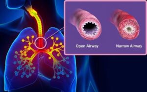 1800ss sciencesource rm airway illustration 1